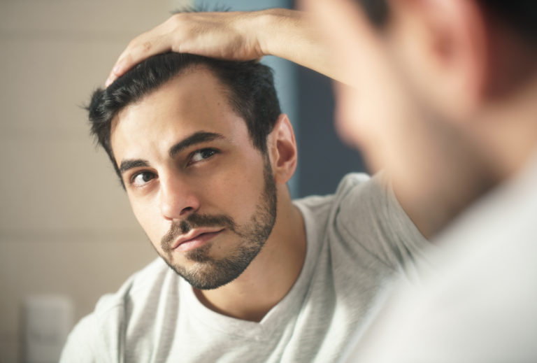 Perte de cheveux